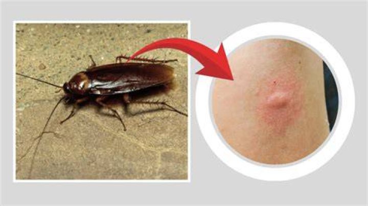 A Cockroach Can Bite With a Force 50 Times Its Body Weight Science